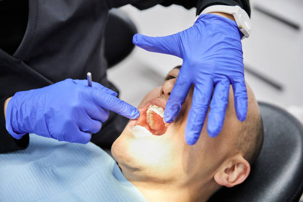 Best Emergency Dental Care for Broken or Chipped Teeth in Teague, TX